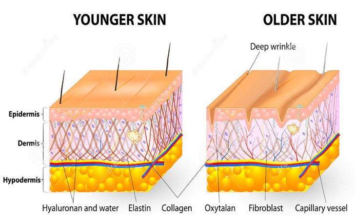 Collagen Biostimulators in Singapore | Mizu