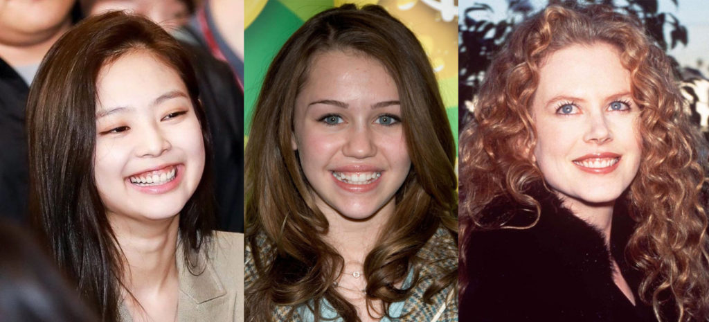 Celebrities with Gummy Smiles | Mizu