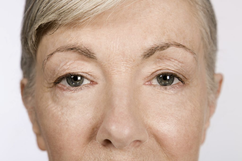 Droopy Eyelids - Eyes of a Senior Woman | Mizu