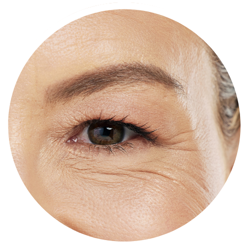 Under Eye Lines - Crepey | Mizu