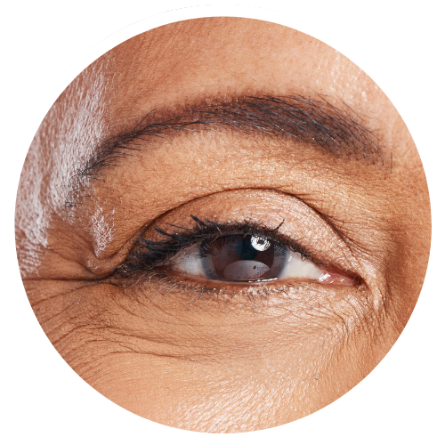 Under Eye Lines - Dynamic | Mizu