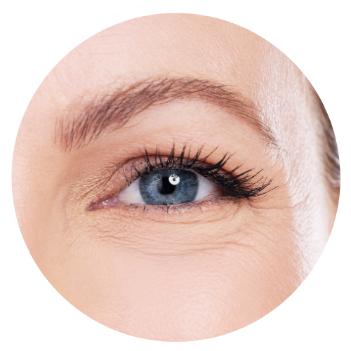 Under Eye Lines - Static | Mizu