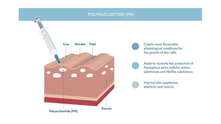 Polynucleotide (PN) Skin Booster Treatment | Mizu