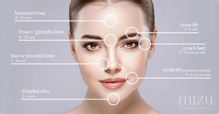 Botulinum Toxin Image | Mizu