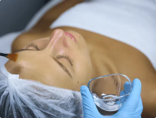 Chemical Peel Treatment | Mizu