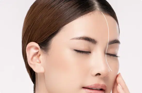 Forehead Fillers | Mizu