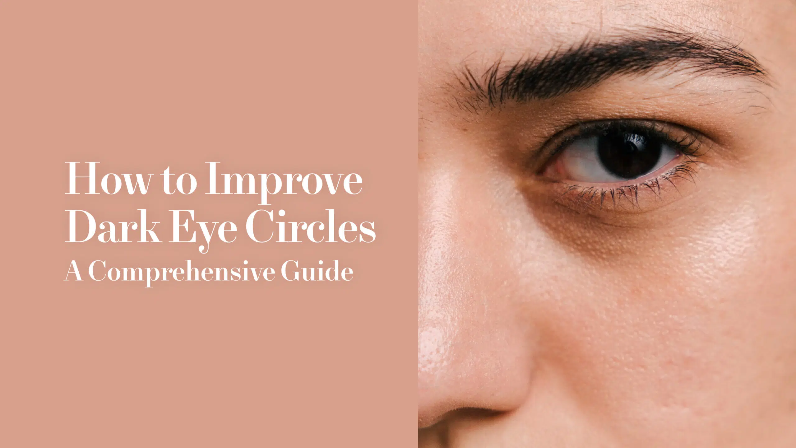 How to Improve Dark Eye Circles: A Comprehensive Guide | Mizu