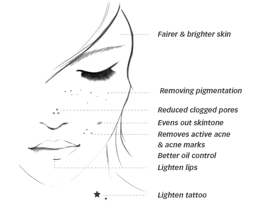 Q-Switched ND-Yag Laser | Mizu