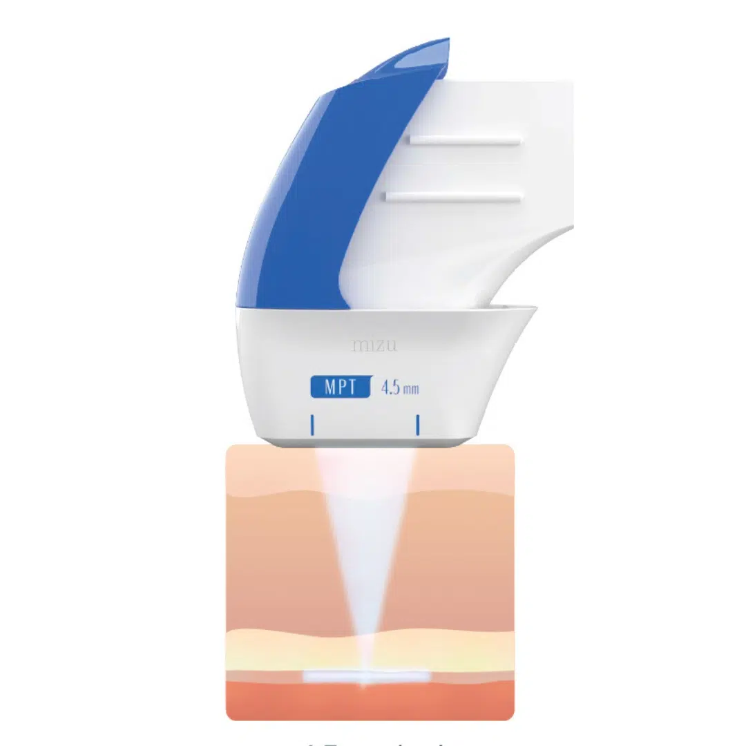 Ultraformer MPT 4.5mm - Device | Mizu